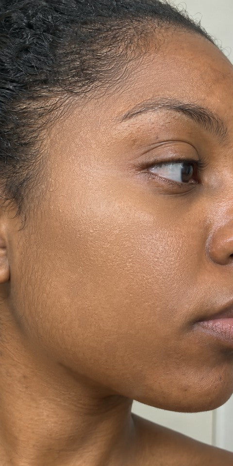 After 6 weeks: dark spots look softer and tone looks more even