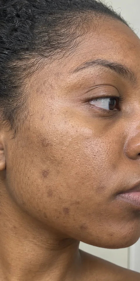 Before: cheek with visible dark spots