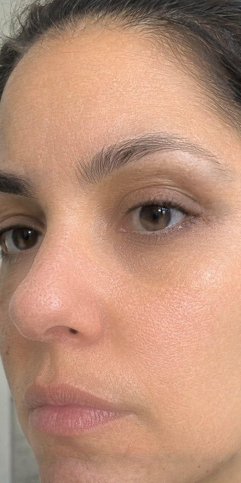 After 6 weeks: brighter-looking skin