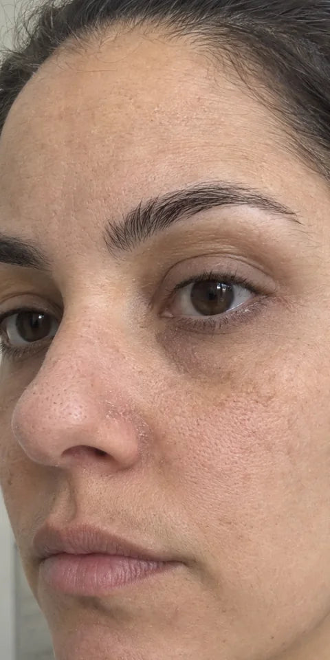Before: dull-looking skin